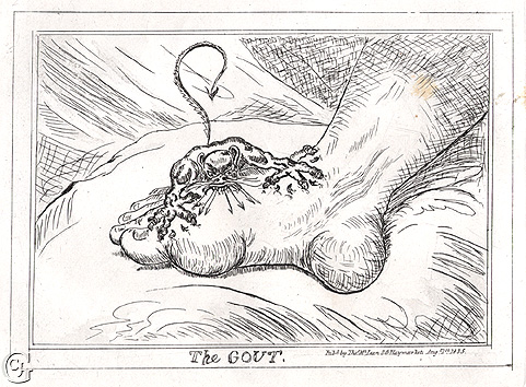 Anonymous (19th Century): The Gout